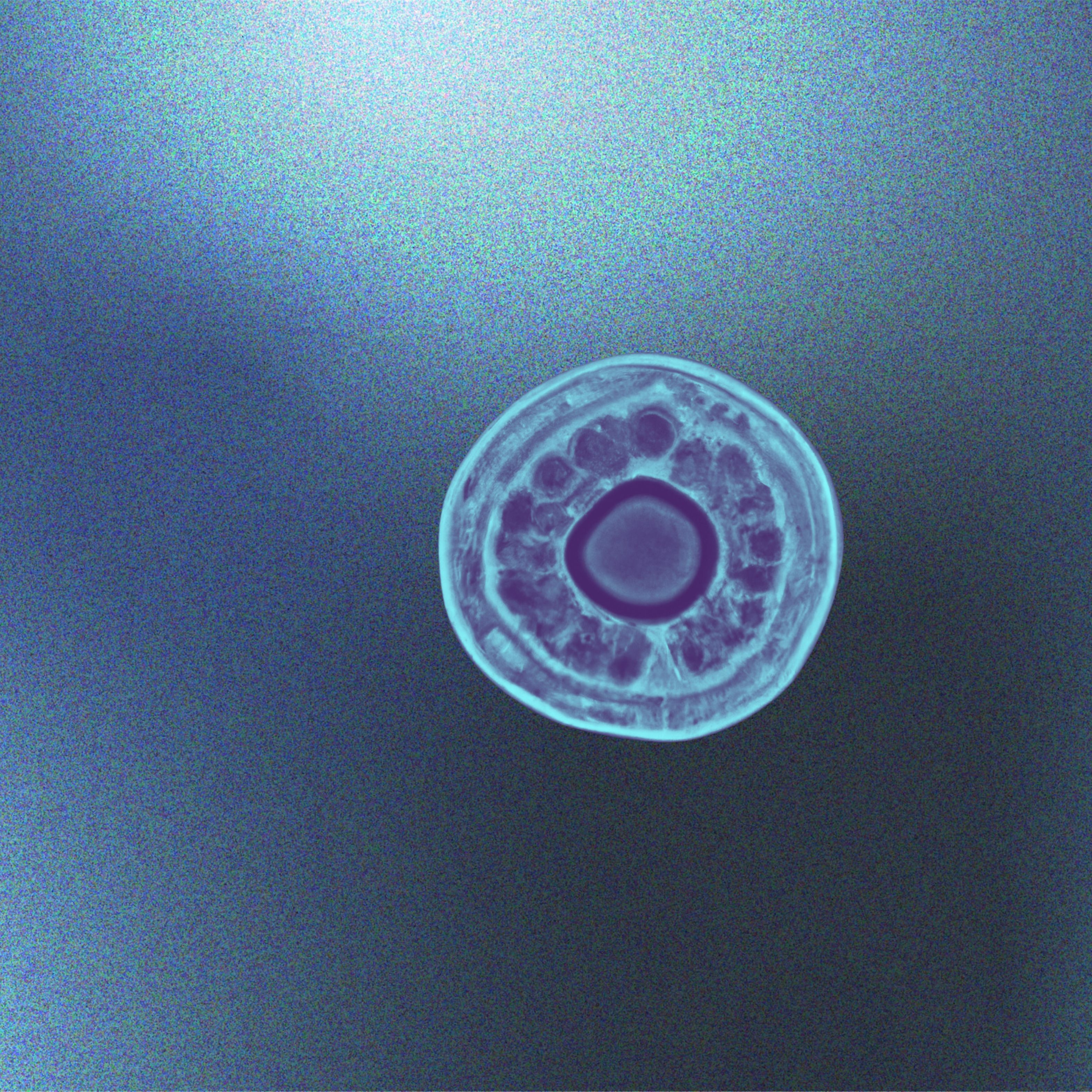 Micro EP